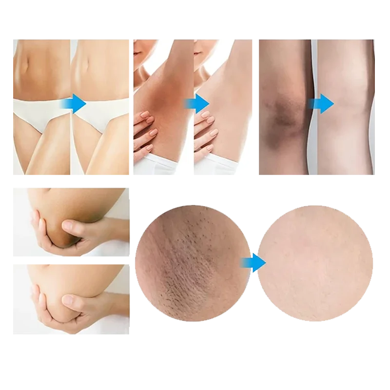 Crema Aclarante De Zonas Oscuras - Image 2